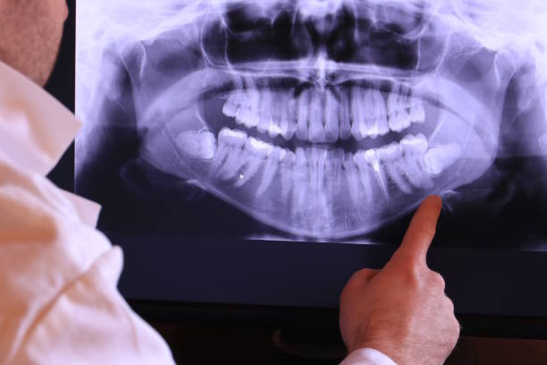 Best Emergency Dental Care for Broken or Chipped Teeth in Lakeview, WA