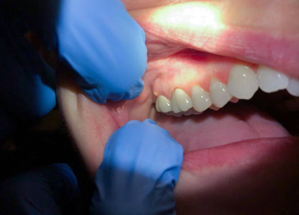Best Cosmetic Emergency Dentistry in Lakeview, WA